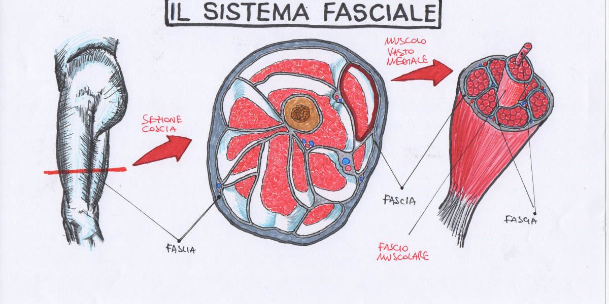 Cura della scoliosi tramite il sistema fasciale