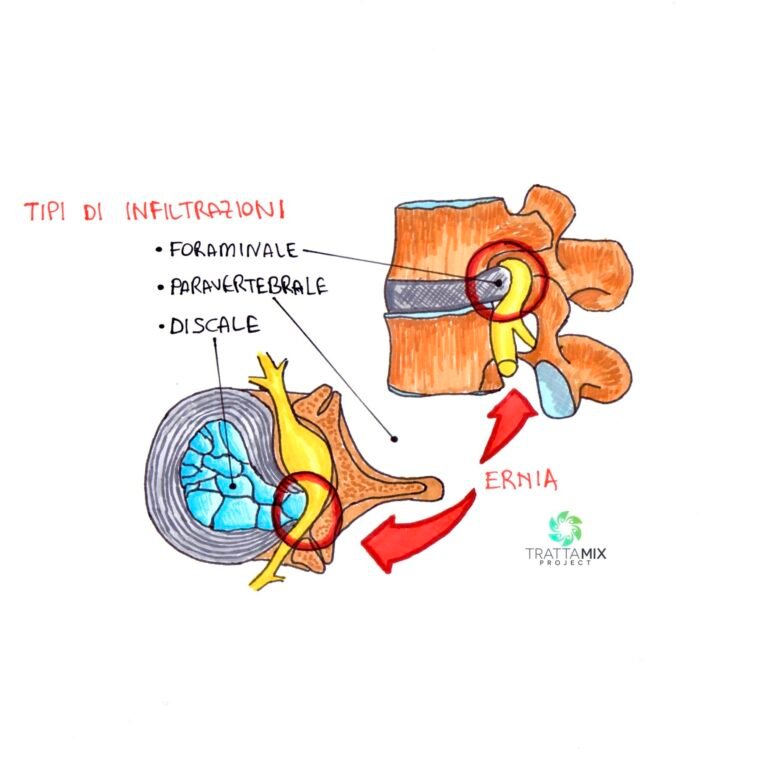 OSSIGENO OZONOTERAPIA COSTI e prezzi 2