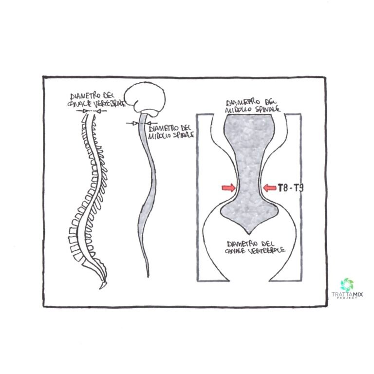 Colpo di frusta sintomi tardivi