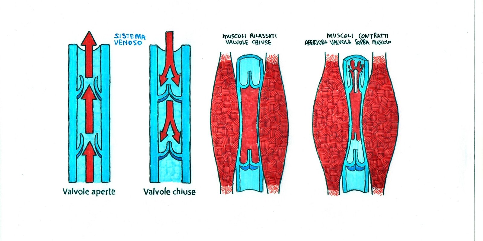 Distorsione alla caviglia gonfiore persistente Distorsione alla caviglia gonfiore persistente