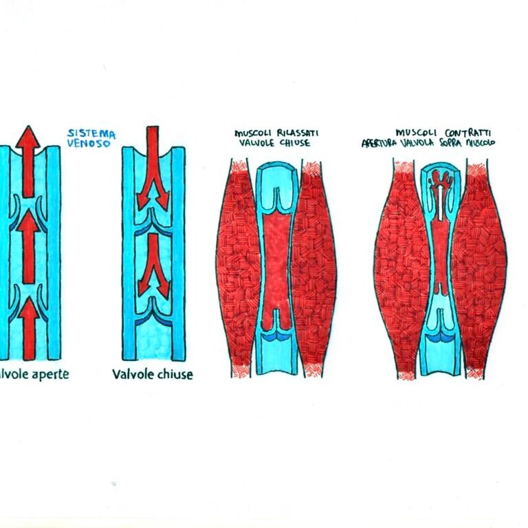 Distorsione alla caviglia gonfiore persistente