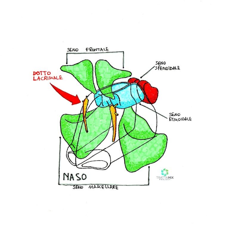 sinusite cura rapida