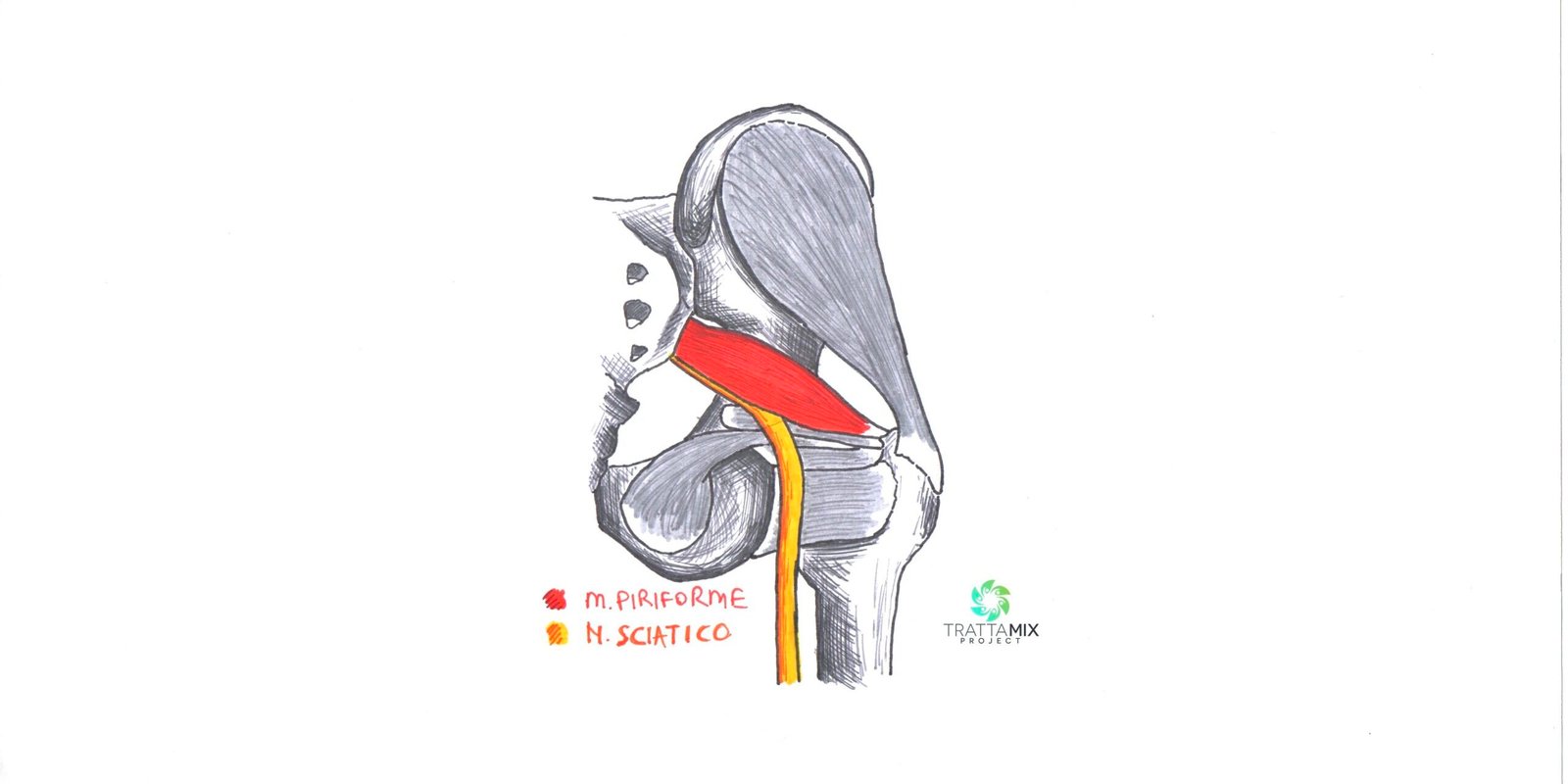 Sdr del piriforme Sdr del piriforme