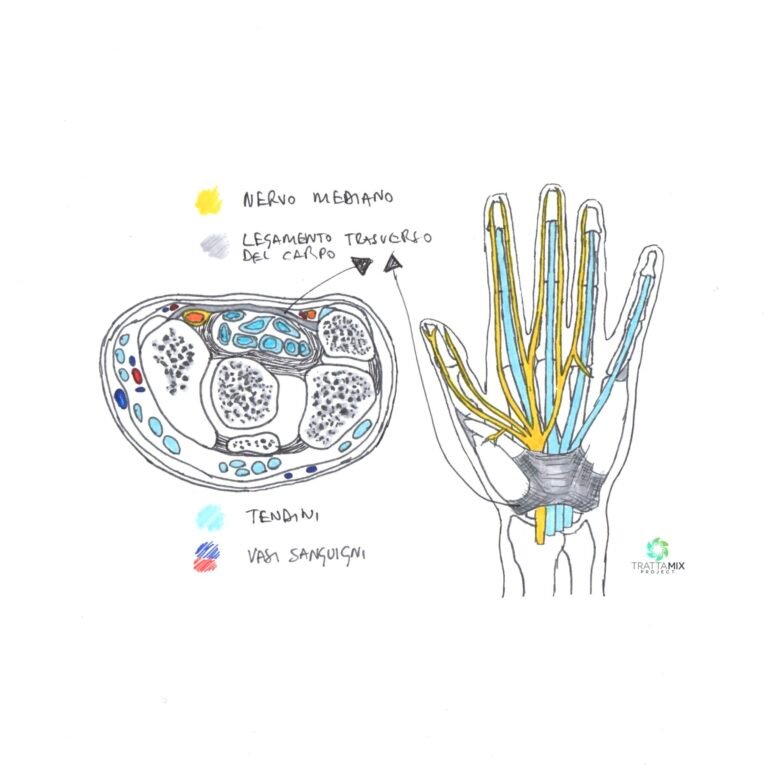 tunnel carpale sintomi spalla